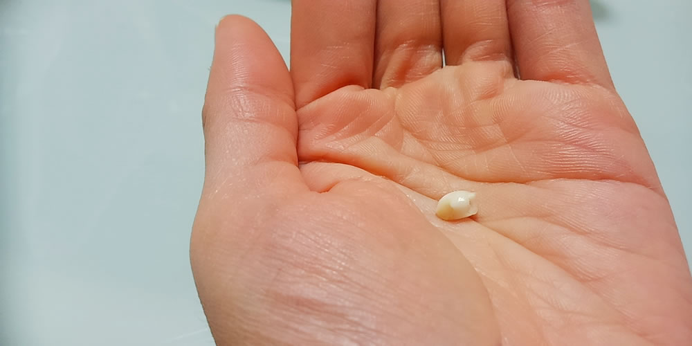 歯が欠けた・抜けたときのNG行動