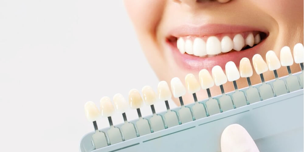 セラミックとCR(コンポジットレジン)の違い