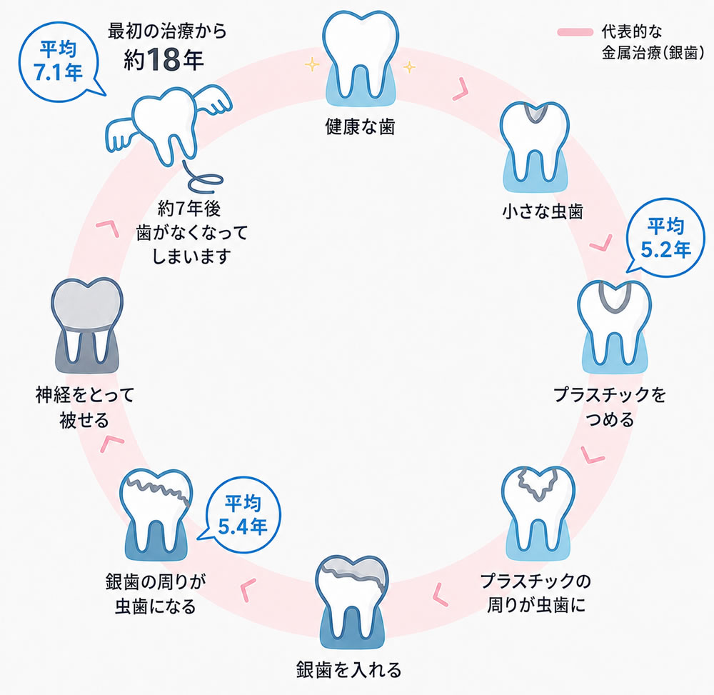 歯の寿命に差が出る理由について