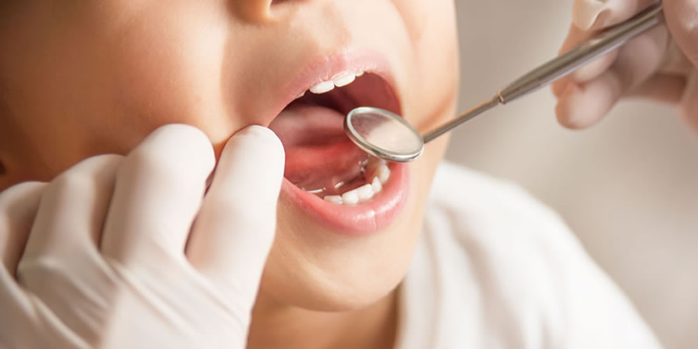 乳歯の虫歯が悪化することで生じる問題