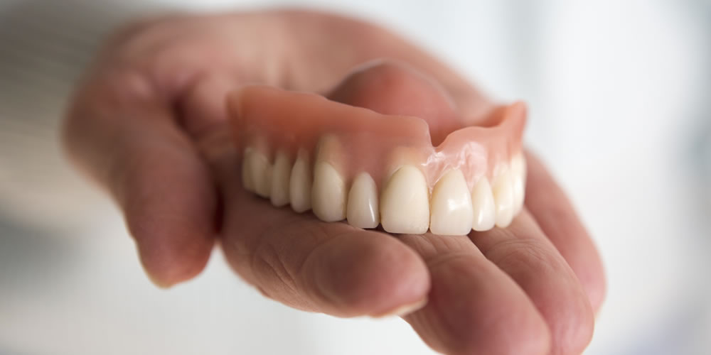 入れ歯の寿命と入れ歯が合わなくなる原因