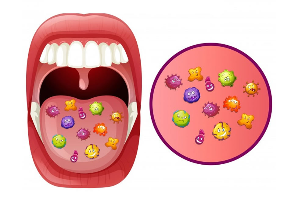 口腔内の細菌
