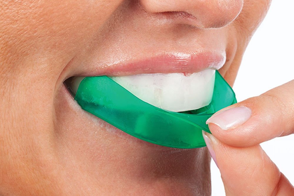 ホームホワイトニング